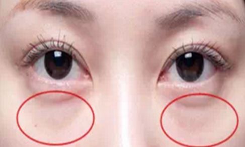 哪位醫(yī)生在八大處能夠為您做出完美的雙眼皮手術(shù)？手術(shù)價格信息附后
