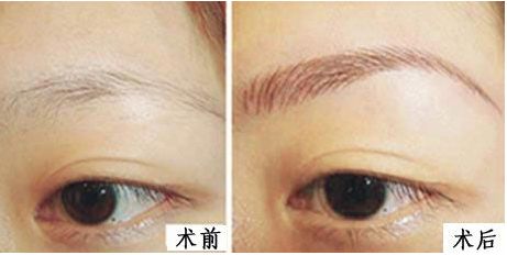 上海九院整形外科醫(yī)生排名新鮮發(fā)布！3位專家各具特長！