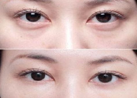 學生黨必備！性價比超高的祛黑眼圈眼霜推薦