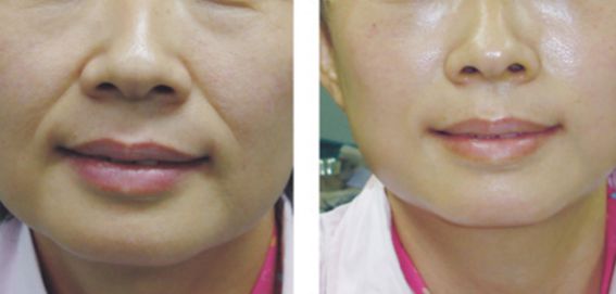哪位醫(yī)生是擅長進行顱頜面手術(shù)的專家？名單更新與價格參考