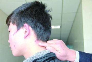 上海哪家醫(yī)院的紋身去除技術(shù)更專業(yè)，排名榜單推薦，實力強大！