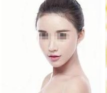 深圳哪家醫(yī)院能安全有效地進行隆鼻整形？