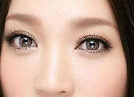 2023年，出色表現(xiàn)的國外進口玻尿酸排行榜前十品牌揭曉！