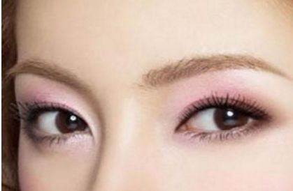 北京協(xié)和醫(yī)院白明醫(yī)生的雙眼皮手術效果如何？真實案例展示給你看