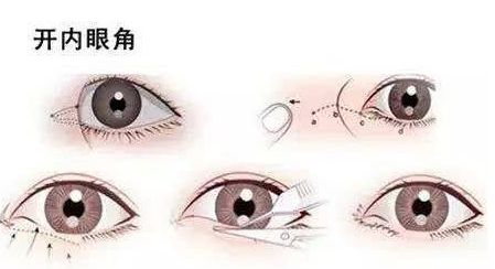 廣州畸形耳朵手術(shù)？值得收藏的醫(yī)院推薦！