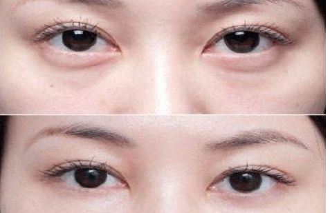 沈陽哪個醫(yī)院的整形專家口碑好，醫(yī)術(shù)高超的醫(yī)生推薦