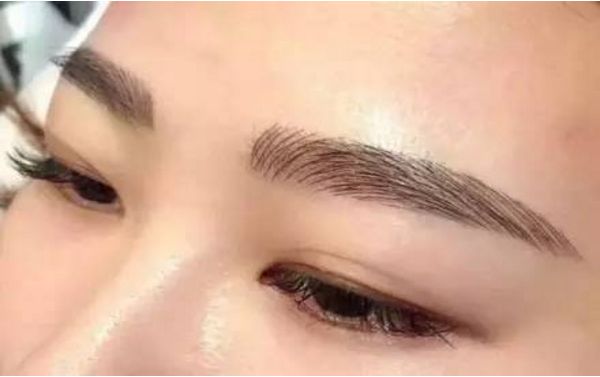 何晉龍磨骨成功，面容煥然一新！讓人難以置信的手術(shù)效果！