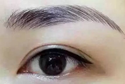 各路醫(yī)生實(shí)力大比拼！同帥與楊亞益，誰在雙眼皮手術(shù)上更出彩？