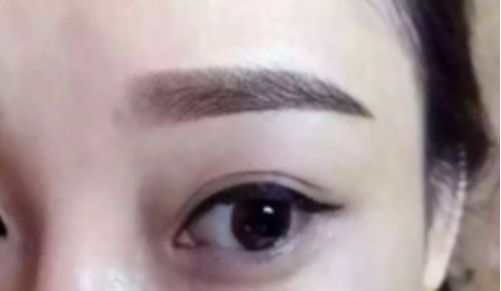鄭州哪家整形醫(yī)院排名前五，取出異物效果好