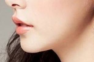 2023天津雙眼皮修復(fù)：醫(yī)生排名與技術(shù)對比，袁強、衛(wèi)星、李小兵等人誰更優(yōu)秀？