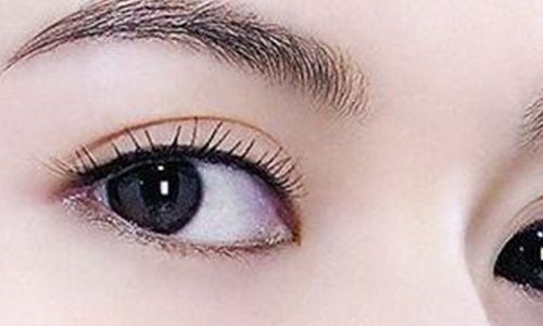 太玲美眸重現(xiàn)！揭秘雙眼皮新趨勢，驚艷效果讓人眼前一亮