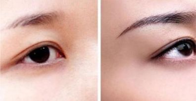 重慶頂尖眼部整形醫(yī)生、醫(yī)院排行榜一覽