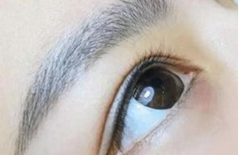 廣州名麗醫(yī)療美容醫(yī)院隆鼻案例分享：真實(shí)口碑大揭秘！