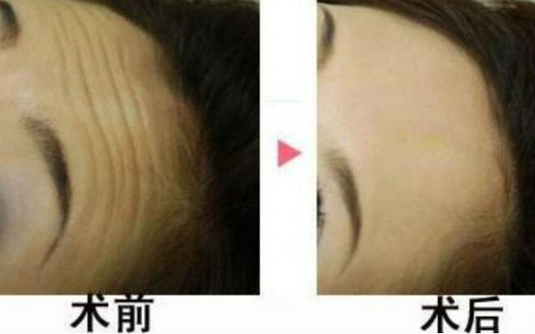 西安陽(yáng)光整形醫(yī)院靠譜嗎？醫(yī)生背景和價(jià)格怎么樣？