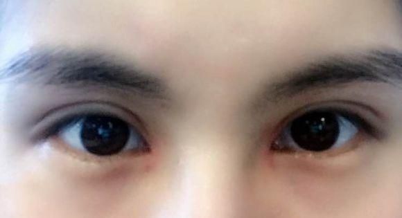 四川華西整形美容科醫(yī)生排行榜前五名，你不能錯過的權威專家！