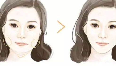 北京哪家整形醫(yī)院的隆鼻效果好？排行榜公開！