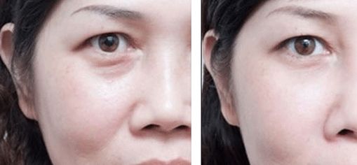 上海治療疤痕的醫(yī)院排名出爐！五家專業(yè)醫(yī)院實(shí)力震撼，趕快了解！