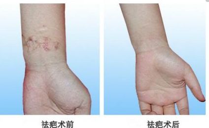 北京自體脂肪隆胸專家真實(shí)排行，專業(yè)技術(shù)精粹一同分享
