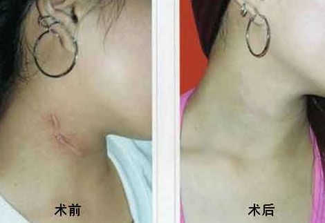 重慶乳房整形六大權威醫(yī)生盤點，高素質(zhì)專家排行曝光