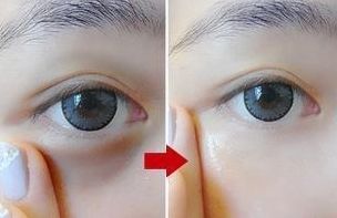 唇部手術(shù)后如何快速恢復(fù)？必須掌握的護(hù)理要點！