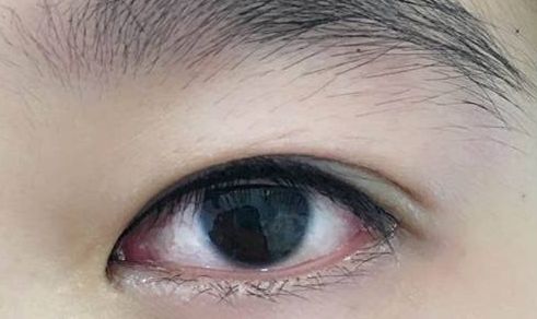上海整形界最受歡迎的吸脂專家推薦，李耐國、曹衛(wèi)剛、李發(fā)成等醫(yī)生備受贊譽(yù)！附真實(shí)案例供參考
