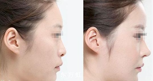 蘇州無線頻率融脂?？漆t(yī)生排名前十這幾位醫(yī)術(shù)聲譽(yù)超卓的醫(yī)生是您的不二之選