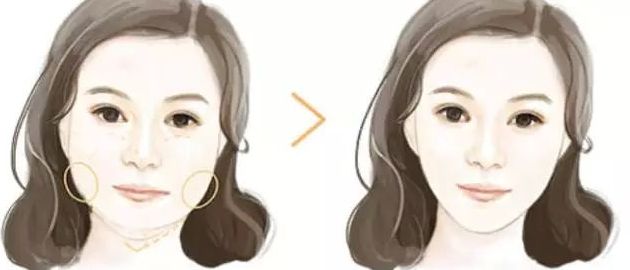 北京黎星醫(yī)生的面部脂肪填充效果如何？真實(shí)案例揭秘！