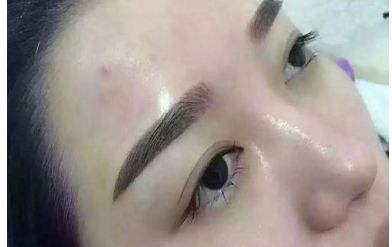 山西二院整形科的醫(yī)生名單更新及熱門項目價格表分享 山西二院整形科的醫(yī)生名單更新及熱門項目價格表分享