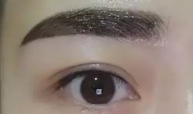 上海瑞格整形醫(yī)院領(lǐng)銜醫(yī)師羅瀾濤——重塑美麗眼睛的魔法使者，成功案例揭秘！