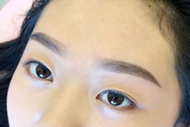 如何優(yōu)雅地?fù)碛须p眼皮？了解專家經(jīng)驗(yàn)與最新案例！