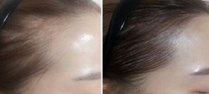 鄭州芳藝醫(yī)療整形醫(yī)院有沒有特色項目？如何一鍵獲??？