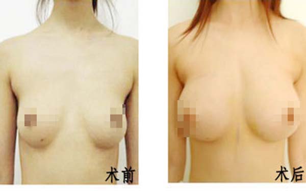 遂寧伊莎貝拉醫(yī)學(xué)美容門診部醫(yī)生是否值得信賴？他們的專業(yè)素質(zhì)如何？