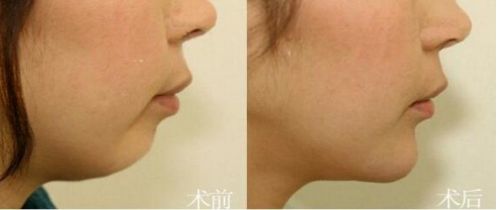 北京市前十名正頜醫(yī)院推薦：八處，協(xié)和，聯(lián)合麗格等，專業(yè)可靠！