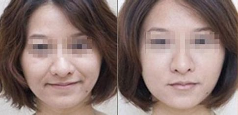 成都有哪些專業(yè)的雙眼皮整形醫(yī)生值得推薦？