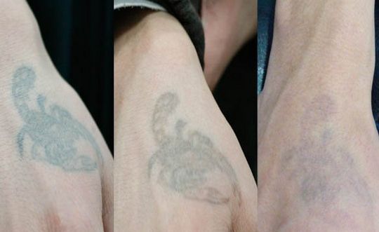 長沙哪家整形醫(yī)院技術(shù)靠譜？私立醫(yī)美還可信嗎？