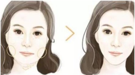 成都哪家口碑整形醫(yī)院好？?jī)A情推薦三家實(shí)力不凡的醫(yī)療機(jī)構(gòu)