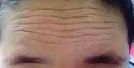 福州鼻部整形醫(yī)院排行榜：絕對(duì)讓你滿意的前十所醫(yī)院，信賴放心！
