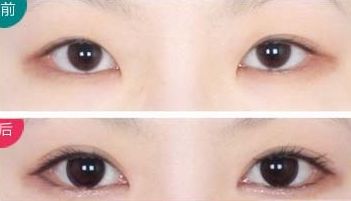 上海最受好評(píng)的乳房整形醫(yī)生推薦！超多病人贊賞王濤、何金光！