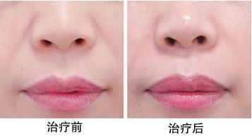 南充最受認(rèn)可的整形醫(yī)院排行出爐！TOP6機(jī)構(gòu)實(shí)力超強(qiáng)，點(diǎn)評不容錯(cuò)過！技術(shù)贊譽(yù)度扶搖直上！