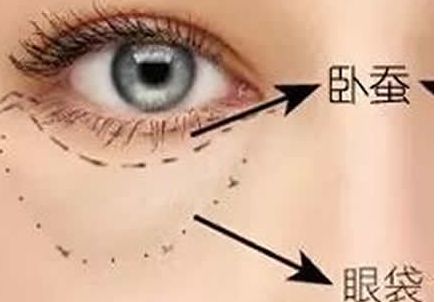北京協(xié)和醫(yī)院隆胸案例與醫(yī)生簡介含金量如何？收費是否合理？