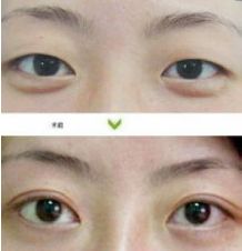 成都哪些醫(yī)生能力出眾進行隆胸術？年度隆胸好醫(yī)生十大排名出爐