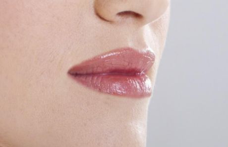 廣醫(yī)一院整形美容科：醫(yī)生實力強，雙眼皮案例為佐證