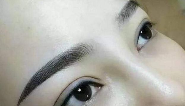 重慶專業(yè)雙眼皮最佳選擇：華美、當代、銅雀臺技術赫赫有名~
