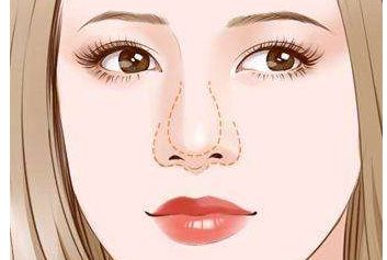 濟(jì)南哪家醫(yī)生做雙眼皮效果好？謝燕燕醫(yī)生實(shí)力及案例揭秘！