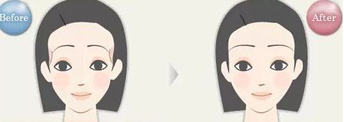 揭密石家莊哪位雙眼皮醫(yī)生備受關(guān)注，優(yōu)點(diǎn)揭秘，價(jià)格參考！