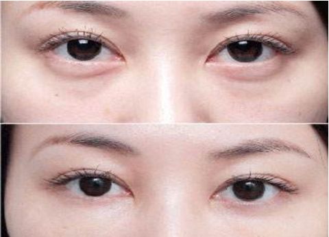 杭州專業(yè)整容醫(yī)療機(jī)構(gòu)排行榜大揭秘！藝術(shù)之星醫(yī)療集團(tuán)對比時(shí)光整形大賽！真實(shí)原因還原無遺！