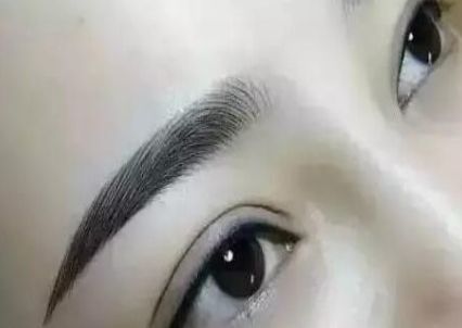 選擇最適合您的雙眼皮手術醫(yī)院-專業(yè)的推薦