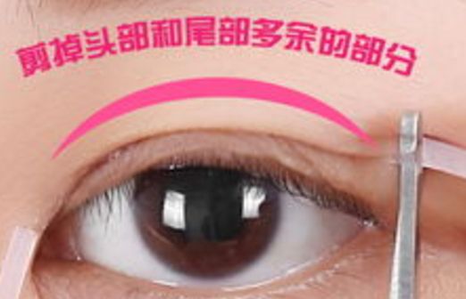 樂(lè)山市人民醫(yī)院眼袋手術(shù)口碑如何？醫(yī)生推薦+真實(shí)案例分析
