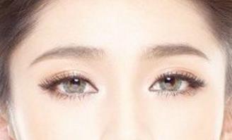 石家莊美聯(lián)臣雙眼皮整形靠譜嗎？有哪些優(yōu)秀醫(yī)生？有什么成功案例供參考？