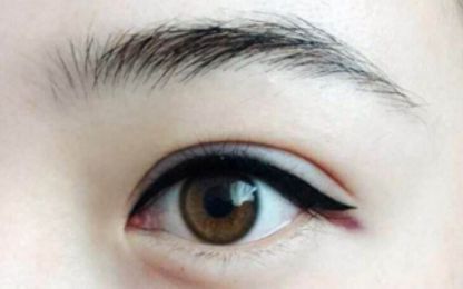 南寧醫(yī)科大雙眼皮整形費(fèi)用及技術(shù)綜述！名單與收費(fèi)指南分享